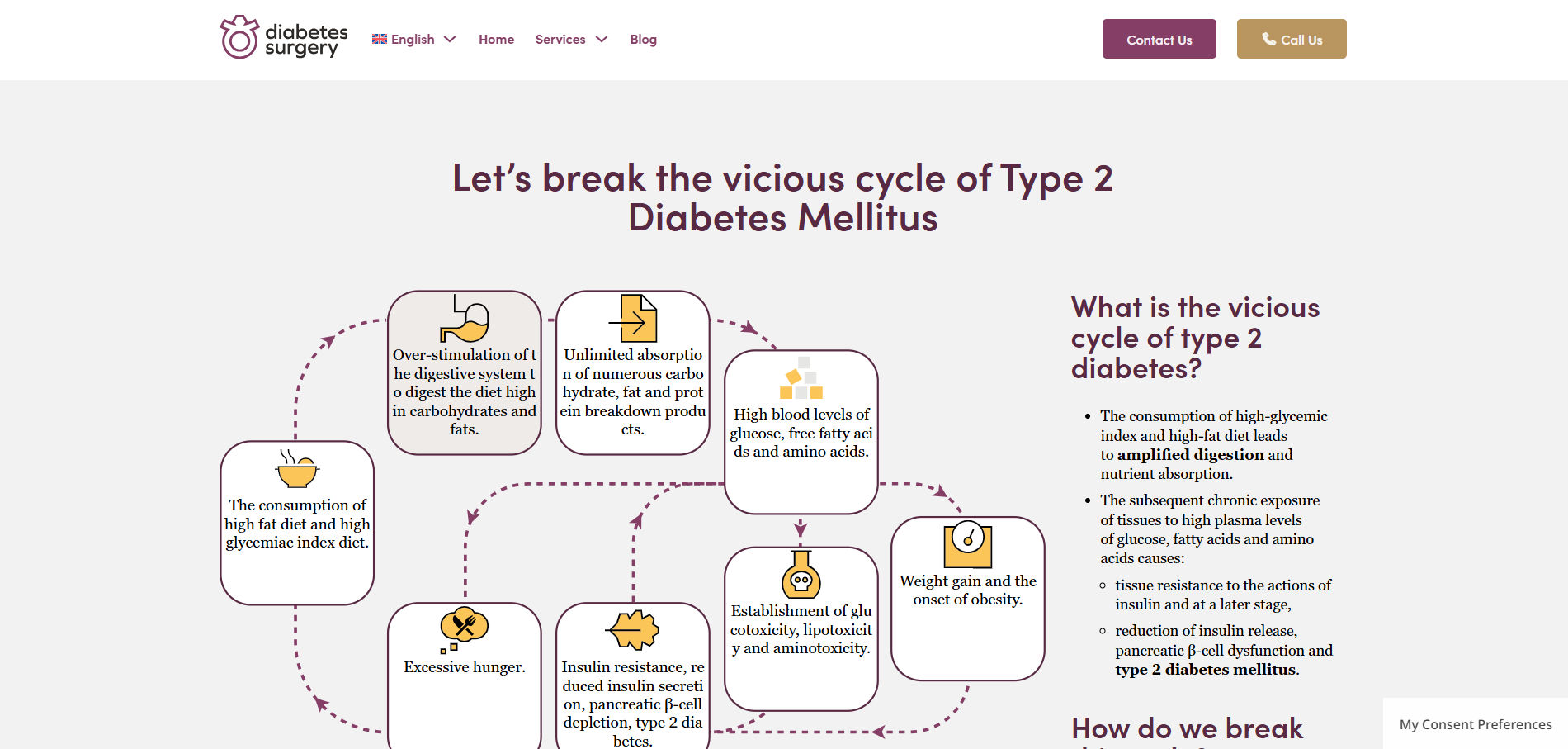 Diabetes Surgery — ιστοσελίδα: Φροντίδα διαβήτη